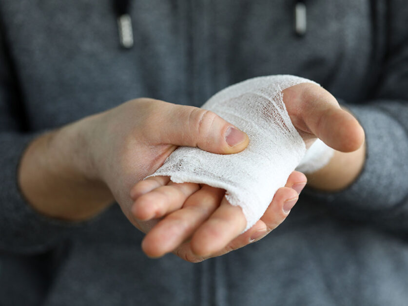 Man shows wounded arm rewound with white bandage